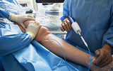 Varicose Vein Treatments Center, New York