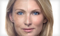 Anti aging treatment India Profile Photos of AAYNA - Cosmetic Dermatology Treatments Ambawatta One,  H5/5, First Floor, Kalka Das Marg, Mehrauli, - Photo 3 of 9
