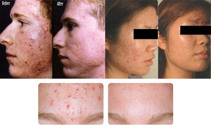  Profile Photos of AAYNA - Cosmetic Dermatology Treatments Ambawatta One,  H5/5, First Floor, Kalka Das Marg, Mehrauli, - Photo 4 of 9