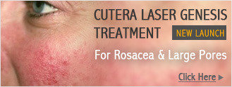 Redness/rosacea laser treatment Profile Photos of AAYNA - Cosmetic Dermatology Treatments Ambawatta One,  H5/5, First Floor, Kalka Das Marg, Mehrauli, - Photo 9 of 9