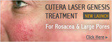 Redness/rosacea laser treatment, AAYNA - Cosmetic Dermatology Treatments, New Delhi