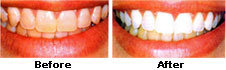  Profile Photos of Friends Orthodontic & Dental Care Centre B-49 Friends Colony (West), New Delhi-110 065, India - Photo 2 of 3