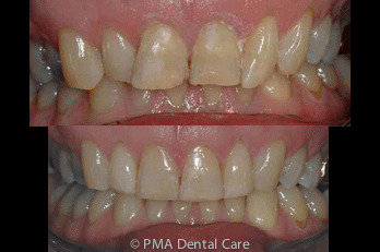  Profile Photos of PMA Dental Care 9 Wrotham Road - Photo 7 of 12