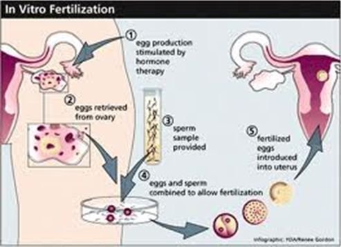  Profile Photos of The Fertility Clinic â€“ IVF Solutions in Delhi B 517 New Friends Colony New Delhi - Photo 3 of 8