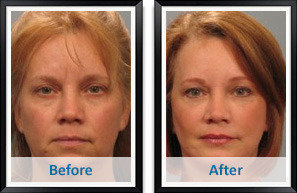  Profile Photos of Atlanta Plastic & Reconstructive Specialists 5673 Peachtree Dunwoody Rd NE #870 - Photo 8 of 11