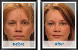 Atlanta Plastic & Reconstructive Specialists, Atlanta