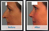 Atlanta Plastic & Reconstructive Specialists, Atlanta