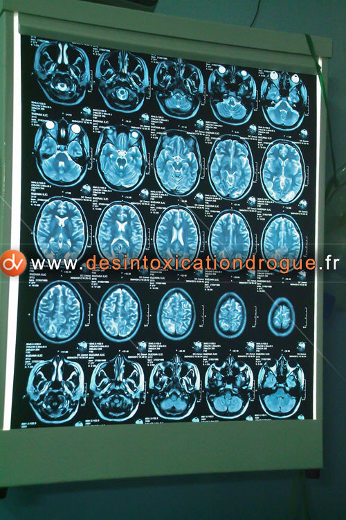  Clinique desintoxication drogue of Centre de dÃ©sintoxication Sremskih boraca 2e - Photo 19 of 25