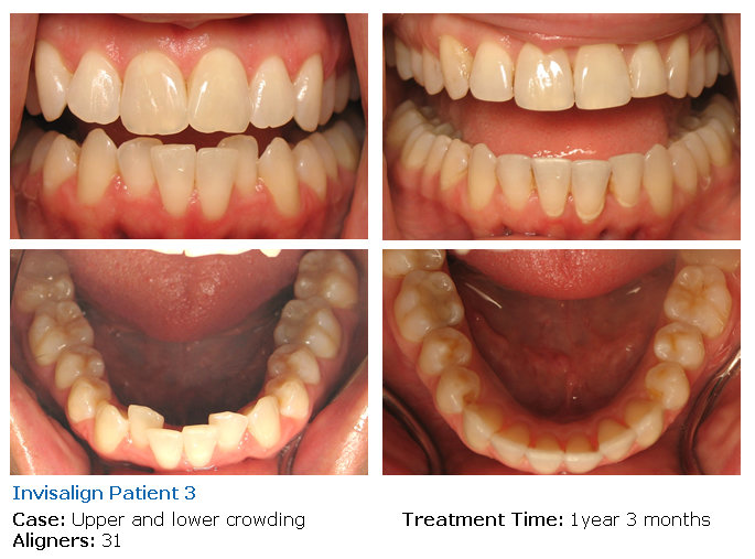  Profile Photos of Westlake Smile Design Invisalign Dentists 911 Hampshire Rd #17 - Photo 1 of 1