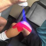 cruotherapy-for-knee pain Cryo-eeze 2552 Merchant Ave 