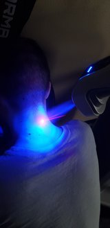 cryotherapy-nexk pain-odessa-fl, Cryo-eeze, Odessa