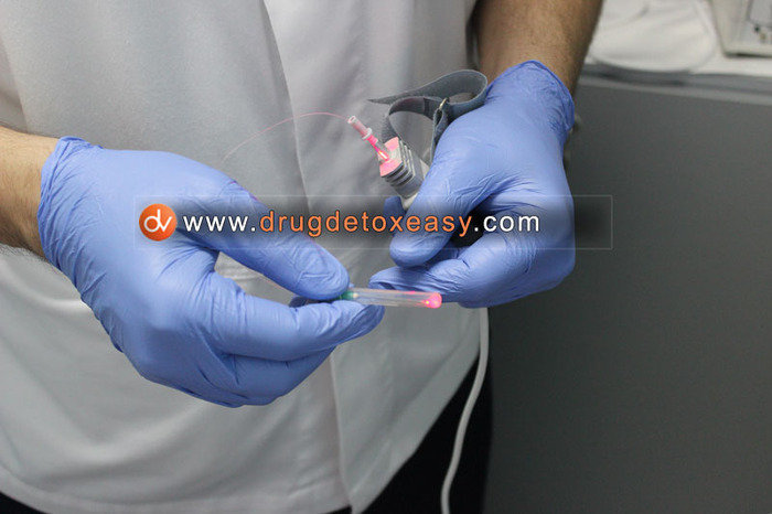 Easy drug detoxification procedure<br />
 Profile Photos of Detox under anesthesia Sremskih boraca 2e - Photo 10 of 16