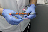 Easy drug detoxification procedure<br />
 Detox under anesthesia Sremskih boraca 2e 