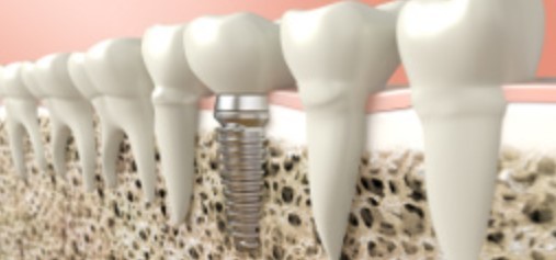  Profile Photos of Cascade Dental : Brown Jerry V DDS 588 E Main St - Photo 3 of 5
