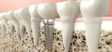 Cascade Dental : Brown Jerry V DDS, Lehi