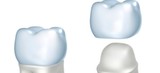 Cascade Dental : Brown Jerry V DDS, Lehi