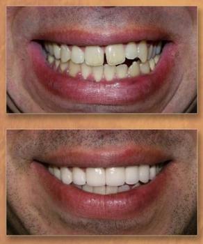  Profile Photos of Elite Dental Rego Park 98-19 64th Avenue, Suite 1H - Photo 2 of 4