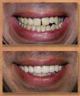 Elite Dental Rego Park, Rego Park