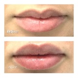  Oxygen & Deep Cleaning Facial 12 E Palisade Avenue, Suite C-17Q 