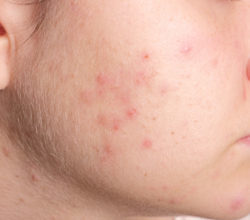 Profile Photos of Bay Dermatology & Cosmetic Surgery 125 4th Ave NE, - Photo 4 of 6