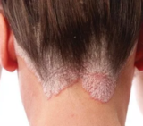 Bay Dermatology & Cosmetic Surgery, St. Pete