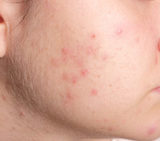 Bay Dermatology & Cosmetic Surgery, St. Pete