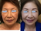  Royal Medical Aesthetic Center: Dustin Zeng, MD, PhD 316 East Las Tunas Drive 