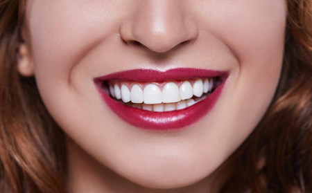  Profile Photos of Porcelain Veneers Brooklyn 3060 Ocean AvenueSuite LN 130 - Photo 2 of 9
