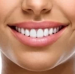  Profile Photos of Porcelain Veneers Brooklyn 3060 Ocean AvenueSuite LN 130 - Photo 4 of 9