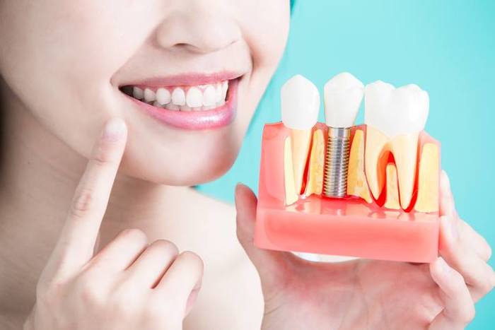  New Album of Tooth Extractions Pickering 1300 Kingston Road Unit #3 - Photo 4 of 15