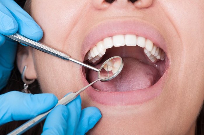  New Album of Tooth Extractions Pickering 1300 Kingston Road Unit #3 - Photo 5 of 15