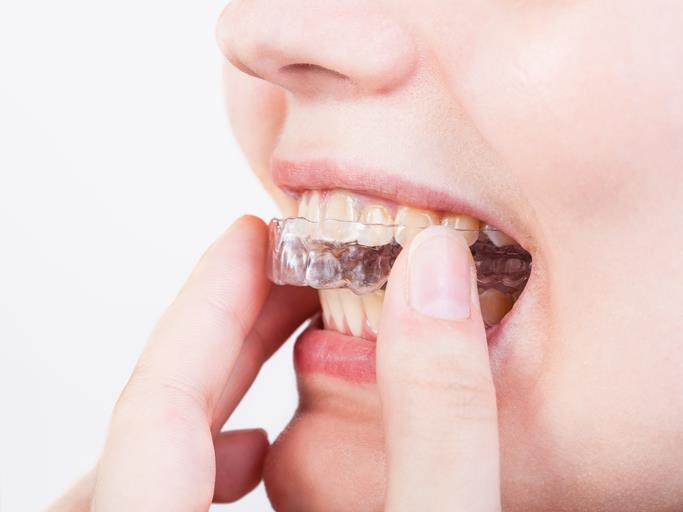  New Album of Tooth Extractions Pickering 1300 Kingston Road Unit #3 - Photo 8 of 15