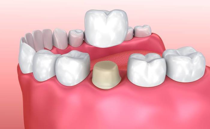 New Album of Tooth Extractions Pickering 1300 Kingston Road Unit #3 - Photo 10 of 15