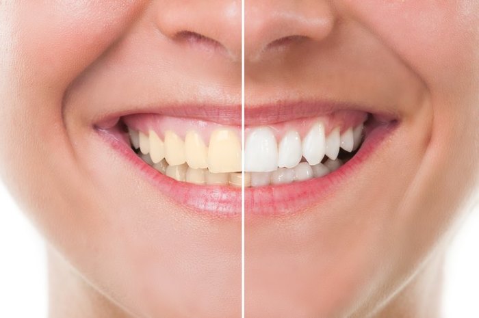  New Album of Tooth Extractions Pickering 1300 Kingston Road Unit #3 - Photo 11 of 15