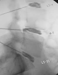  Profile Photos of Global Neuro & Spine Institute - Palm Bay 1501 Robert J Conlan Blvd. NE Suite #3 - Photo 10 of 11