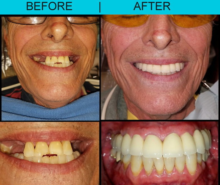  Profile Photos of Dr. Jose J. Alvarez & Associates 3483 NE 163rd St. - Photo 18 of 25