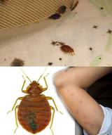 Bedbugs Control Sydney, Sydney