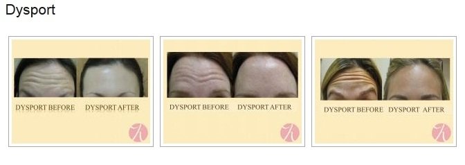 Khrom Dermatology & Aesthetics Profile Photos of Khrom Dermatology & Aesthetics 2797 Ocean Parkway, 3rd Floor - Photo 5 of 8