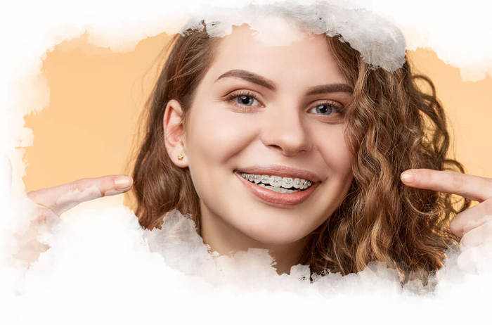 Traditional metal braces are an incredibly effective method of orthodontic treatment. These braces are what most people think of when they think of orthodontic treatment but technology has enhanced their effectivenes. Profile Photos of Embassy Row Orthodontics 2132 R St. N.W. - Photo 2 of 6