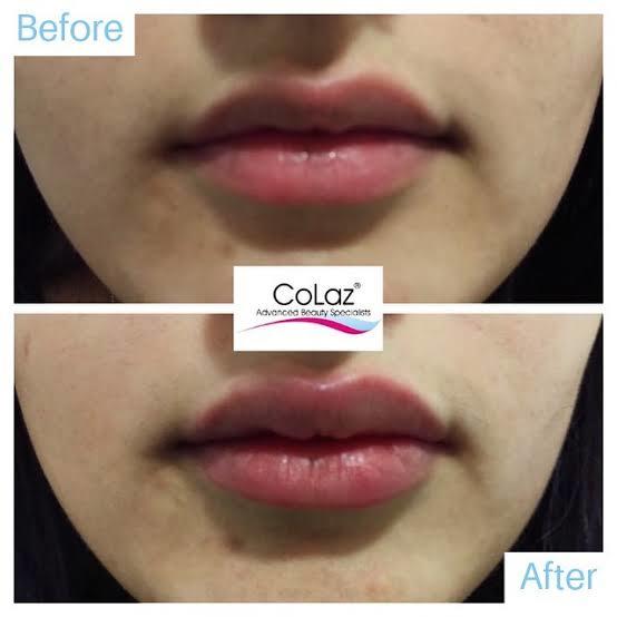  New Album of Colaz Advanced Aesthetics Clinic - Harrow 464 Alexandra Ave - Photo 5 of 19