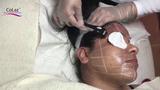 Colaz Advanced Aesthetics Clinic - Harrow, Harrow