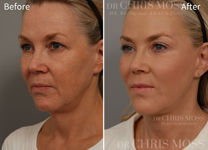  Profile Photos of Chris Moss Plastic Surgery 504 Toorak Road - Photo 1 of 6