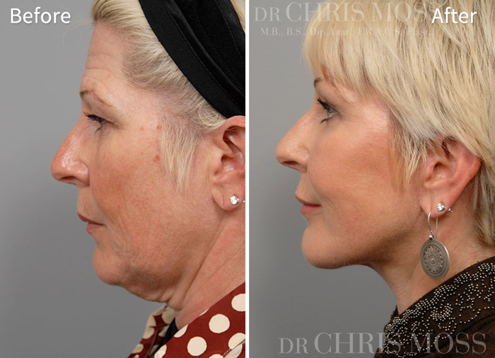 Profile Photos of Chris Moss Plastic Surgery 504 Toorak Road - Photo 2 of 6
