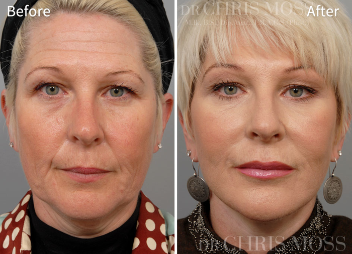  Profile Photos of Chris Moss Plastic Surgery 504 Toorak Road - Photo 3 of 6