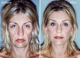 Chris Moss Plastic Surgery, Toorak