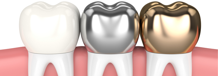  New Album of Dental Crowns 5221 Church Ave - Photo 2 of 2