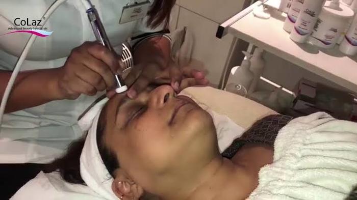  Profile Photos of Colaz Advanced Aesthetics Clinic - Paddington 31 Southwick St - Photo 9 of 17