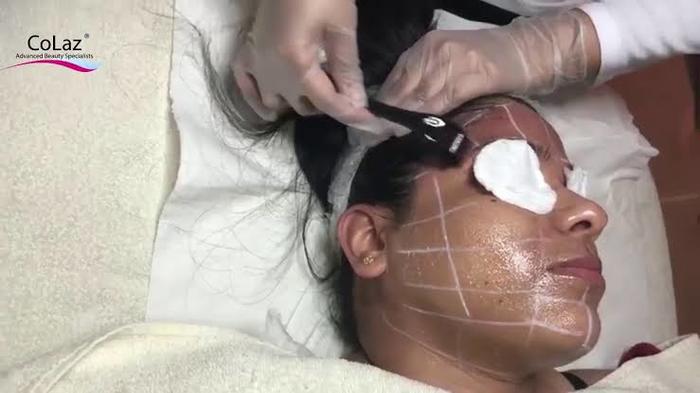  Profile Photos of Colaz Advanced Aesthetics Clinic - Paddington 31 Southwick St - Photo 4 of 17