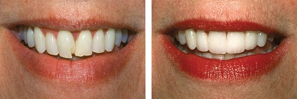  Profile Photos of Lakefront Family Dentistry | Derek Hauser, DDS 31571 Canyon Estates Dr #117 - Photo 4 of 11