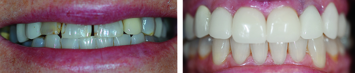  Profile Photos of Lakefront Family Dentistry | Derek Hauser, DDS 31571 Canyon Estates Dr #117 - Photo 7 of 11